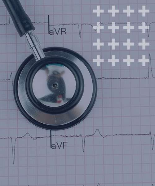 18-Lead-ECG